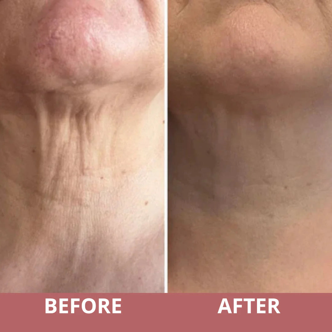 Firmé™ Tighten & Lift Neck Cream