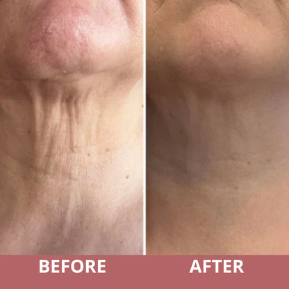 Firmé™ Tighten & Lift Neck Cream